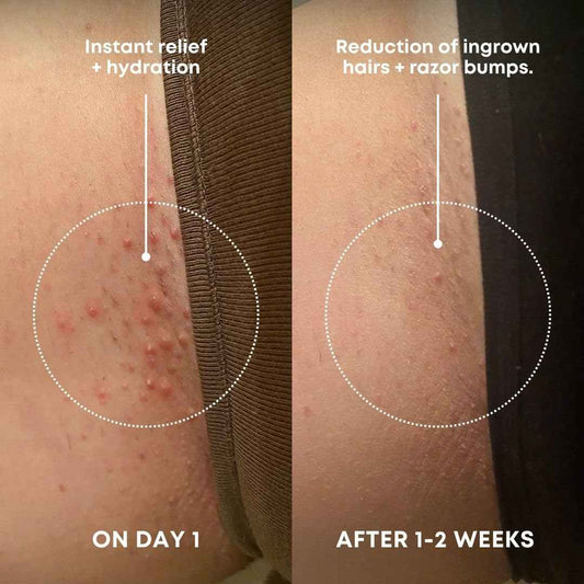 Bushbalm Ingrown Hair Exfoliating Scrub - Reduces Appearance of Ingrown Hairs and Razor Bumps, Soothes Skin and Post-Shave Redness - Nude, 236 ml 🍁 All In One Marketplace Canada