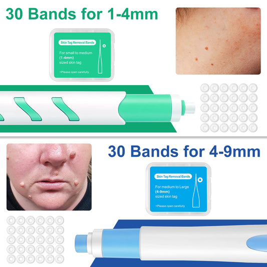 Skin Tag Tool,For Small to Large Skin Tags 1-9mm Painless Skin Tag Removal Kit Tools with 60 Removal Bands And 36 Repair Patches & 20 pcs Cleansing Wipes Easy to Use 🍁 All In One Marketplace Canada