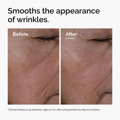 The Ordinary Multi-Peptide + Hyaluronic Acid, Anti-Aging Peptide Serum for Crow’s Feet, Elasticity & Firmness, 30 ml 🍁 All In One Marketplace Canada
