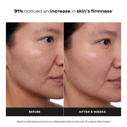 Paula's Choice CLINICAL 1% Retinol Treatment Cream with Peptides, Vitamin C & Licorice Extract, Anti-Aging Treatment for Wrinkles & Loss of Firmness, Fragrance-Free, 30 mL 🍁 All In One Marketplace Canada