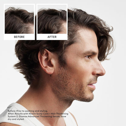 Nioxin Scalp + Hair Thickening System 2 Shampoo, For Natural Hair with Progressed Thinning, 16.9 fl oz (Packaging May Vary) 🍁 All In One Marketplace Canada