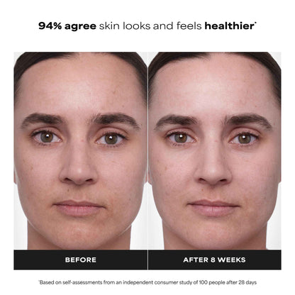Paula's Choice CLINICAL 1% Retinol Treatment Cream with Peptides, Vitamin C & Licorice Extract, Anti-Aging Treatment for Wrinkles & Loss of Firmness, Fragrance-Free, 30 mL 🍁 All In One Marketplace Canada