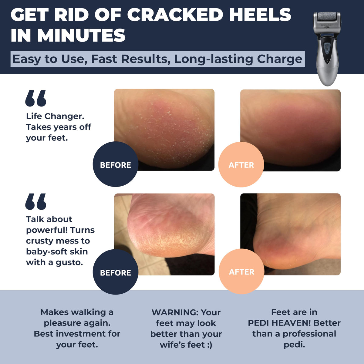 Callus Remover: Electric Rechargeable Pedicure Tools for Men/Women by Own Harmony w 3 Rollers (Tested Powerful) Best Foot File,Professional Spa Electronic Micro Pedi Feet Care Perfect for Cracked Skin 🍁 All In One Marketplace Canada