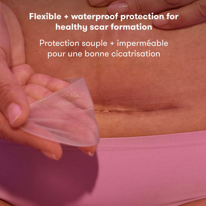 Frida Mom C-Section Silicone Strips, C-Section Recovery Must Have Scar Patches, Reusable Medical Grade Treatment for Keloid Scars, Includes Case & Pouch 🍁 All In One Marketplace Canada