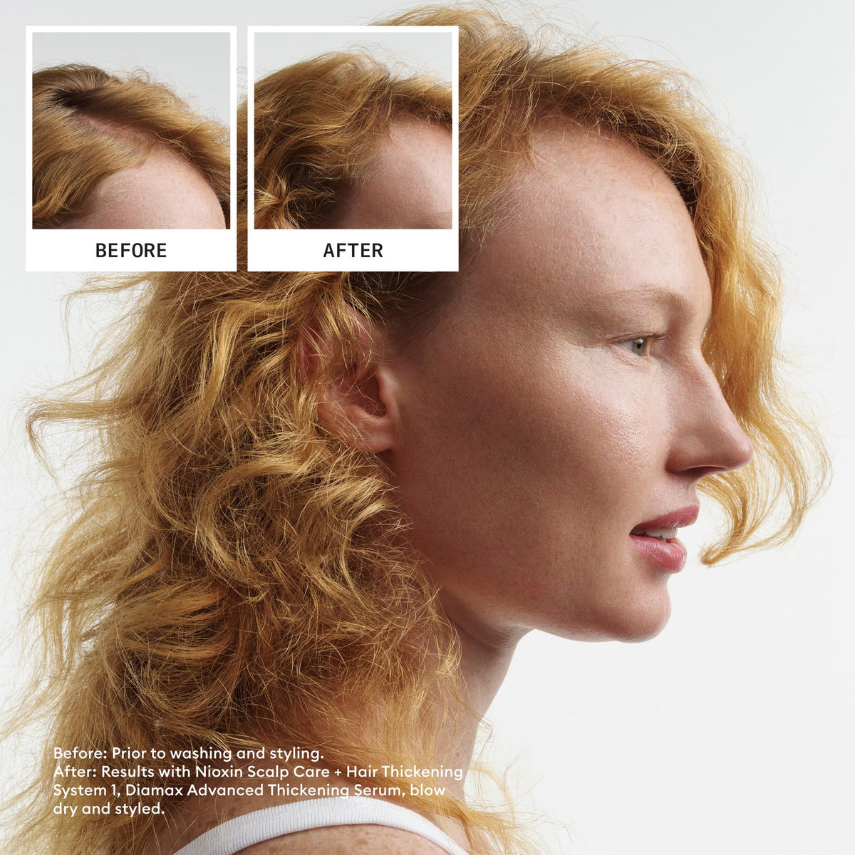 Nioxin System 1 Scalp + Hair Thickening Shampoo | For Natural Hair with Light Thinning | Strengthen Against Breakage with Niacinamide & Biotin | 16.9 Fl Oz 🍁 All In One Marketplace Canada