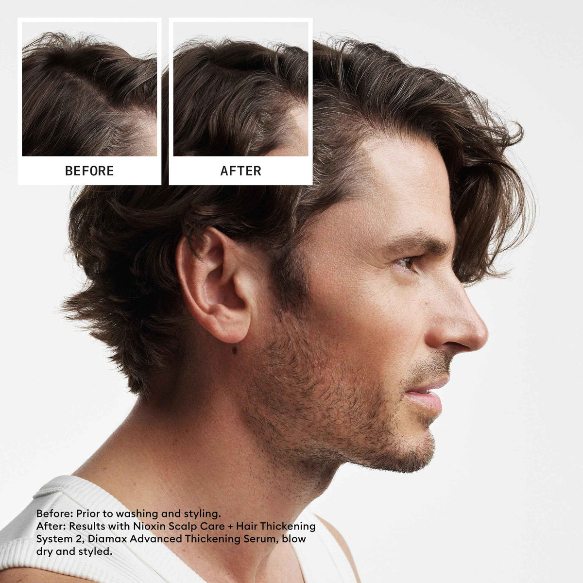 Nioxin Scalp + Hair Thickening System 2 - Hair Thickening System for Natural Hair with Progressed Thinning, Trial Size (Packaging May Vary) 🍁 All In One Marketplace Canada