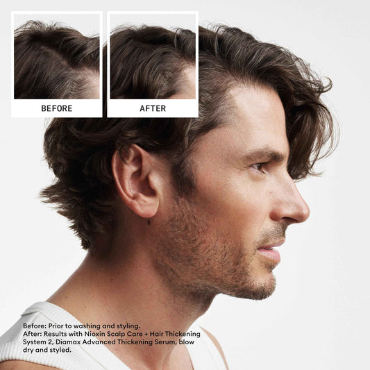 Nioxin Scalp + Hair Thickening System 2 - Hair Thickening System for Natural Hair with Progressed Thinning, Trial Size (Packaging May Vary) 🍁 All In One Marketplace Canada