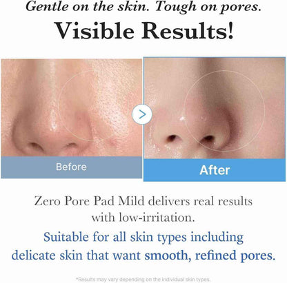 Medicube Zero Pore Serum 37ml